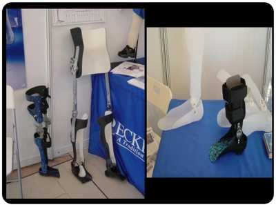 假肢與矯形器 功能、技術與應用概述