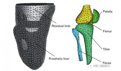 增材制造技術(shù) 假肢與矯形器領(lǐng)域的個性化革新