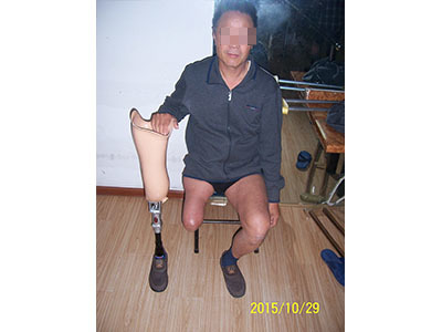 青島假肢與矯形器服務(wù)探析——以青島市遠征假肢矯形器為例